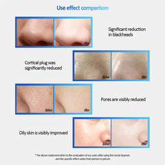 Facial Cleansing Sonic Brush - Gaivana