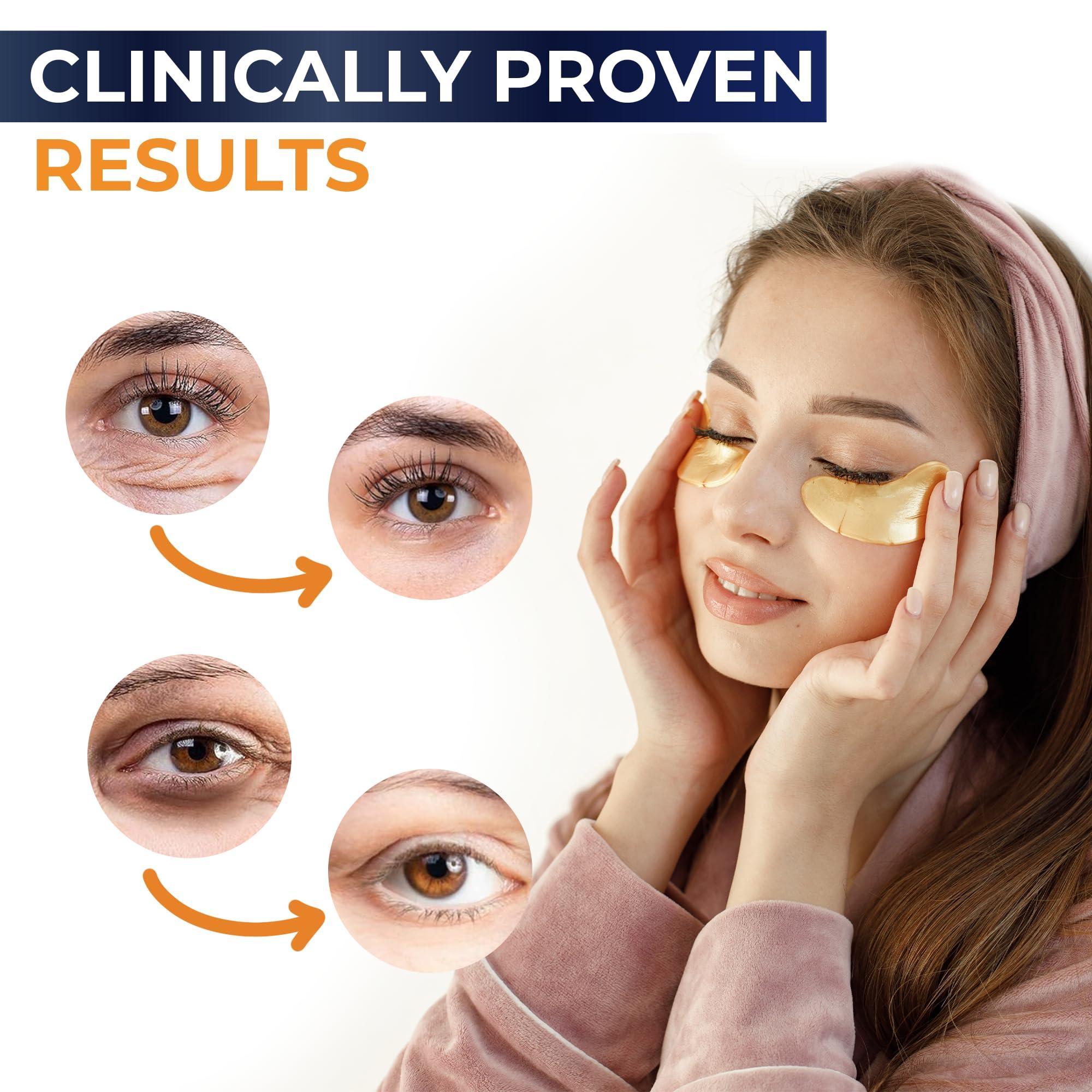 Gaivana under eye patches for puffy eyes and dark circles, 30 pairs of anti-aging eye masks showing soothing gel pads.